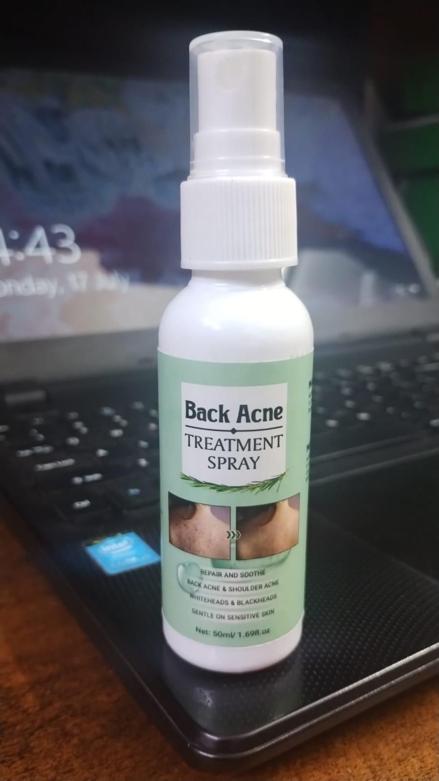 Back Acne Treatment Spray (Pack of 2)